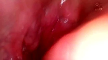 x1x884CAC2BE9FC4BC907