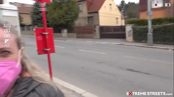 EXTREME STREETS - Vaginal Prolapse