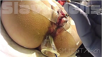 Peehole Training. Pee And Squirts! A Very Thick Metal Rod Is Put In And Out Of The Urethra Orgasm